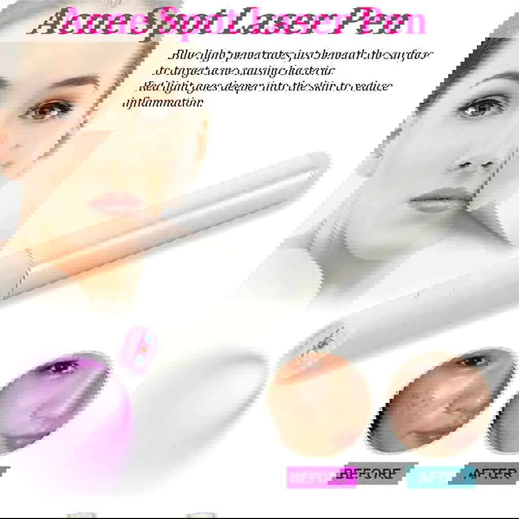 Red Blue Light Therapy Pen - Woman`s Clothing