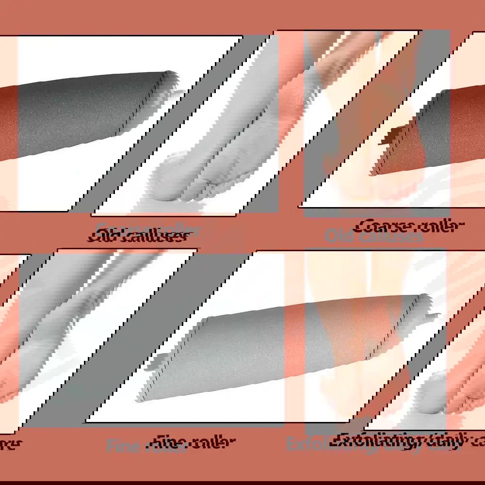 VelvetStep Foot Exfoliator - Woman`s Clothing