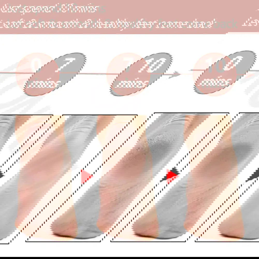 VelvetStep Foot Exfoliator - Woman`s Clothing