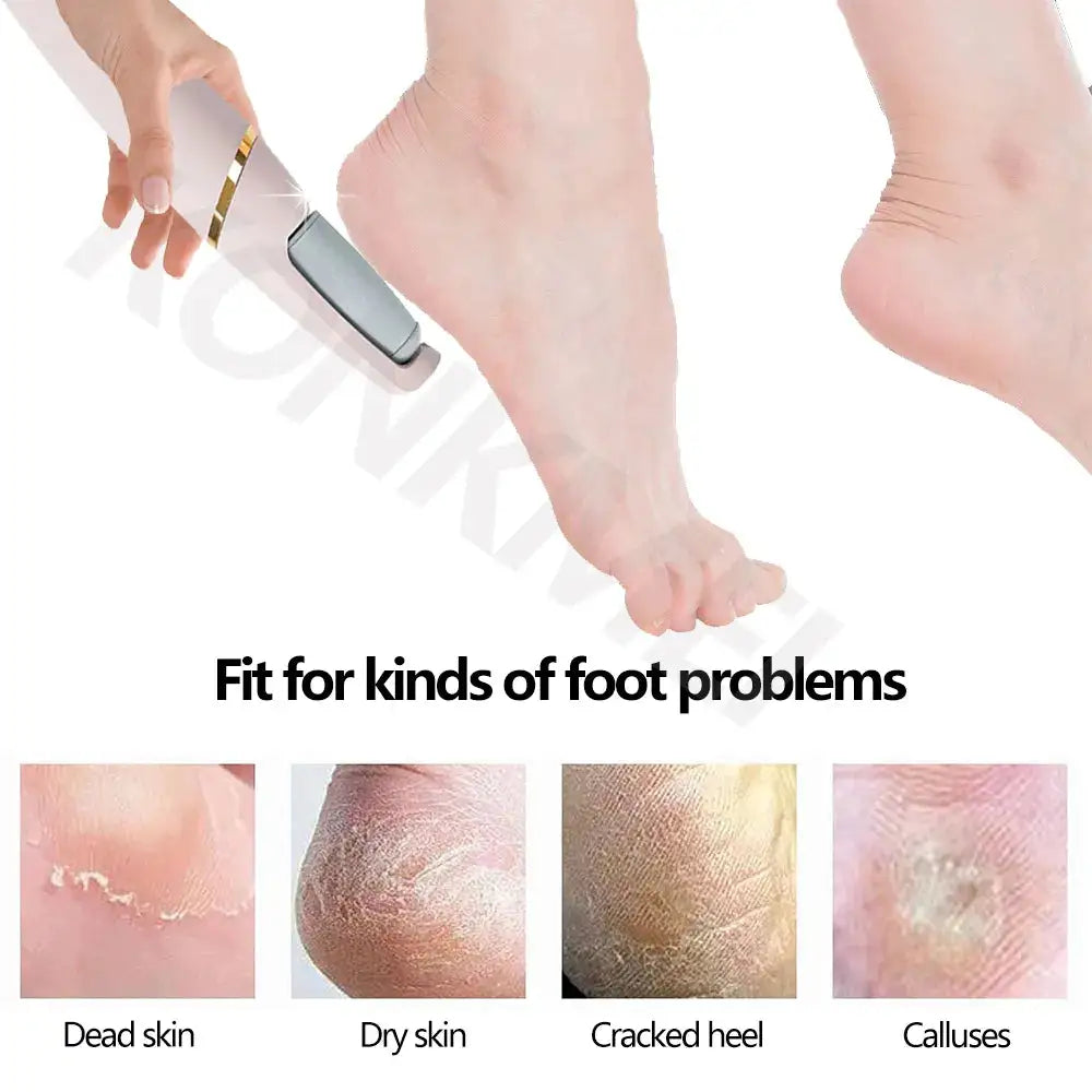 VelvetStep Foot Exfoliator - Woman`s Clothing