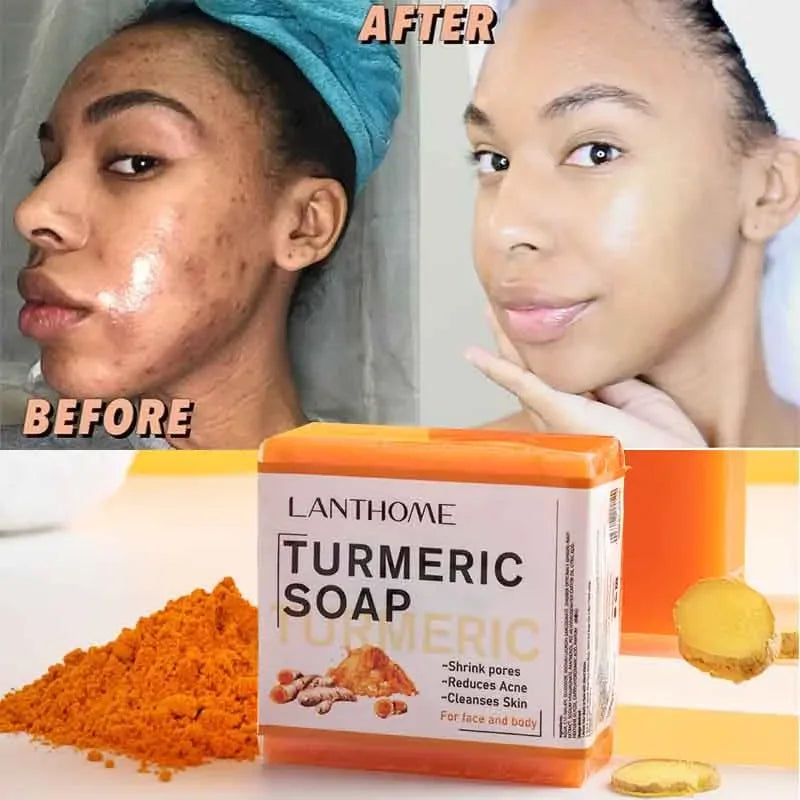 Turmeric Soap Face Cleansing Anti Acne - Woman`s Clothing